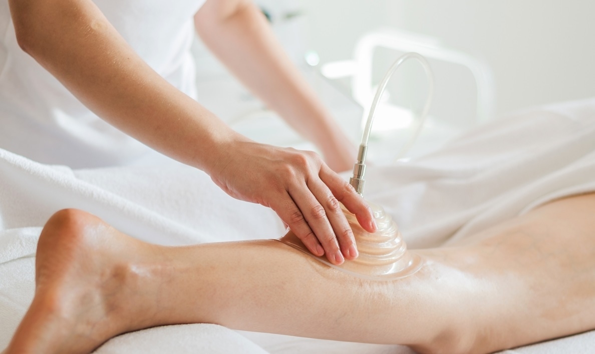 Ozonioterapia